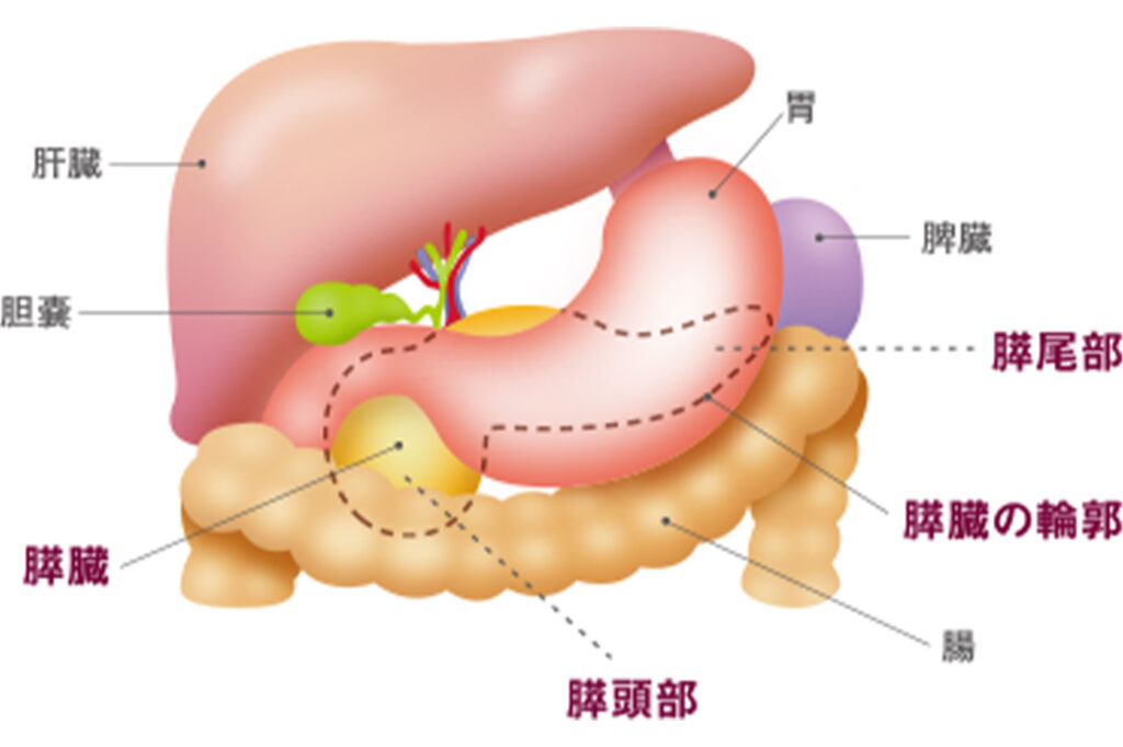 増加している膵臓がんを発見するために
発見困難ながん、リスク因子と最新検査